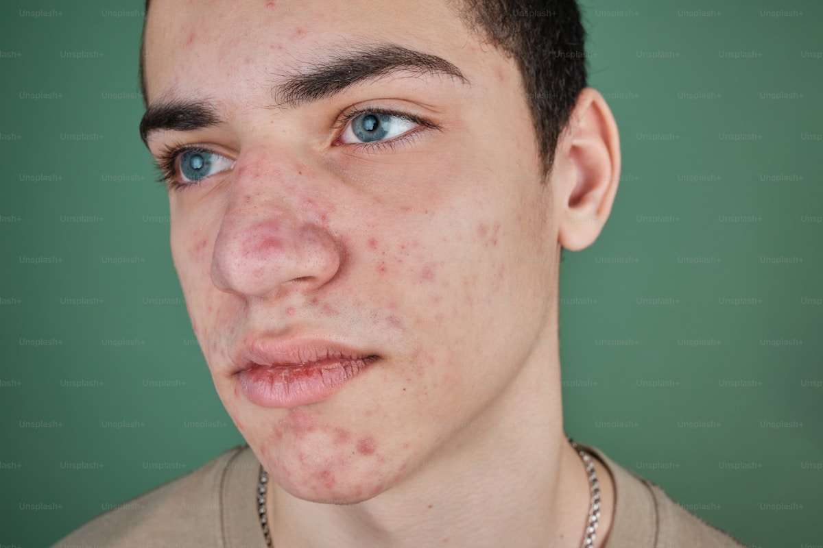 Dull sun-damaged skin treatment